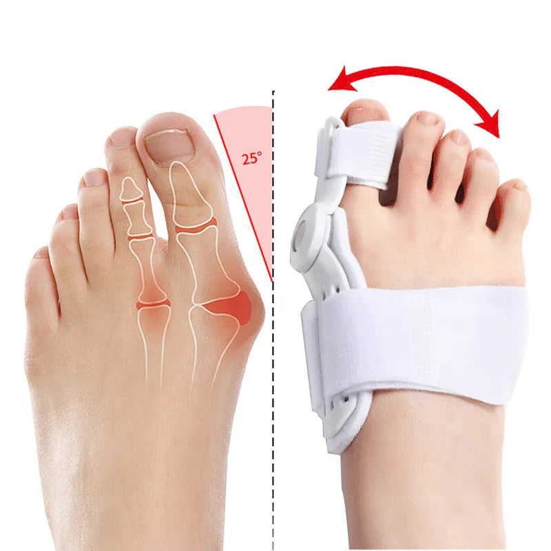 Hallux Valgus Bunion Corrector