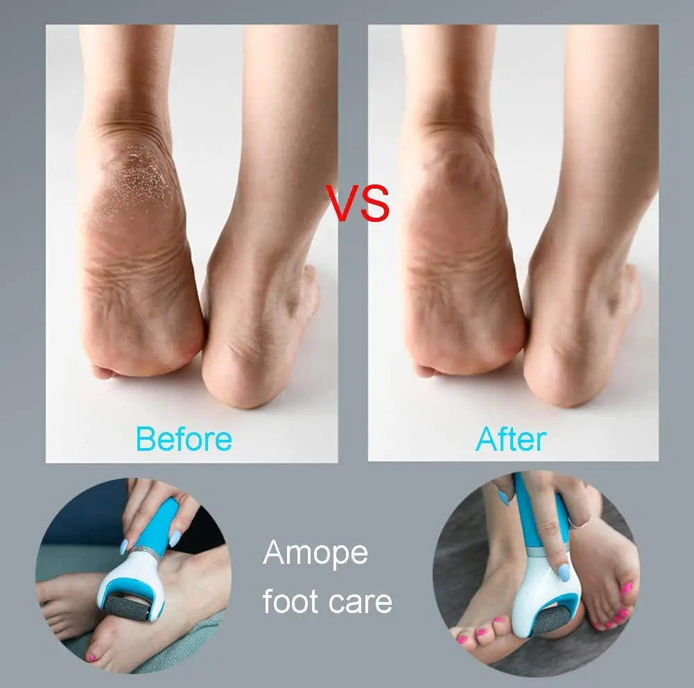 Electric Foot File Set Foot Callouses Dead Skin Remover Shaver painless.