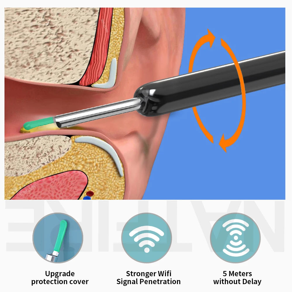 Smart Visual Ear Cleaner