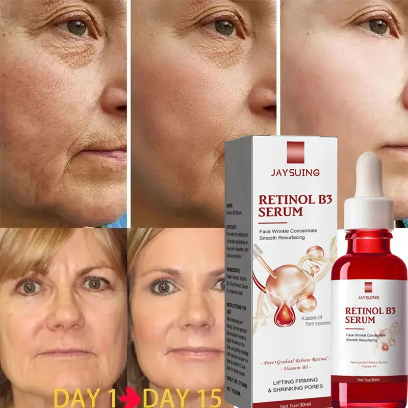 Retinol Wrinkle Remover, anti aging Face Serum