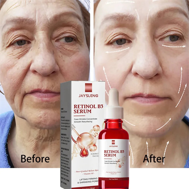 Retinol Wrinkle Remover, anti aging Face Serum